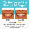 SwiftSmile™ – Wittere tanden in slechts 30 seconden